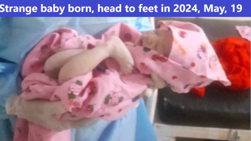 Strange baby born, head to feet in 2024